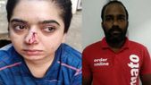 ஆரம்பமான Men Too மொமெண்ட்: சொமாட்டோ ஊழியர் பெண் மூக்கை உடைத்தாரா?- வெளியான உண்மை தகவல்!