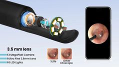 1,299 रुपये वाला यह जादुई डिवाइस करता है आपके कान की सफाई