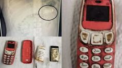 നോക്കിയ 3310 ഫോൺ അപ്പാടെ വിഴുങ്ങി 33കാരൻ, പുറത്തെടുത്തത് ശസ്ത്രക്രിയയിലൂടെ