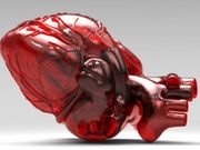 3D-Printed Hearts to Reduce Heart Surgeries in Kids