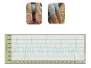 Wearable Sensor can Accurately Monitor Patient's Health