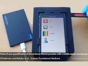 Smartphone Raapidly Detects Parasite levels in Blood