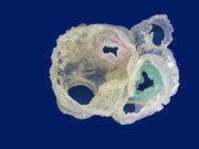First 3D heart printed using multiple imaging techniques