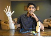 Indian teen creates low-cost robotic arm