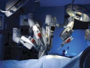 Robot performs first kidney surgery in China