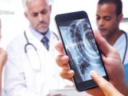 Now Smartphone Microscope Can Detect Skin Cancer