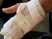 HTC Desire 10 Pro explodes on woman’s hand