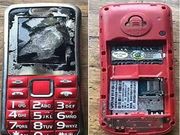 Phone explodes while charging; leaves a 12-year-old partially blind