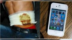 Story of a Chinese man who actually sold his kidney to buy an iPhone