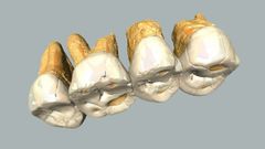 Remains of new human species found in Philippines