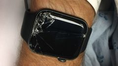 Apple Watch Saves Another Life: An Inspiring Facebook story
