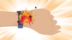 Smart Band Explodes On User's Wrist Leaving Third-Degree Burns