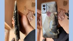 Another OnePlus Nord 2 Bursts Into Flames: User Suffers Heavy Burns