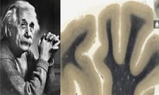 ಆಪಲ್‌ ಆಪ್‌ ಸ್ಟೋರ್‌ನಲ್ಲಿ ಐನ್ಸ್‌ಟೈನ್‌ನ ಮೆದುಳು ಖರೀದಿಸಿ