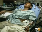 ಸೆಲ್ಫಿಗೆ ಮರುಳಾಗಿ ಕೈಯನ್ನೇ ಕಳೆದುಕೊಂಡ!