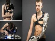 ಅಚ್ಚರಿ: ಈತನ ಕೃತಕ ಕೈಯಲ್ಲಿದೆ ಡ್ರೋನ್, ಫೋನ್ ಬ್ಯಾಟರಿ ಚಾರ್ಜರ್