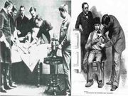 ಮೈ ನಡುಗಿಸುವ ಪುರಾತನ ಶಸ್ತ್ರಕ್ರಿಯೆ ವಿಧಾನಗಳು