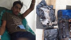 ಬೈಕ್‌ನಲ್ಲಿ ಚಲಿಸುವಾಗ ಪ್ಯಾಂಟ್ ಕಿಸೆಯಲ್ಲಿದ್ದ ಮೊಬೈಲ್ ಬ್ಲಾಸ್ಟ್‌!