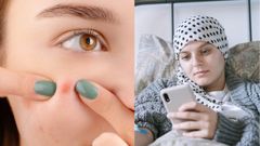 ಸ್ಮಾರ್ಟ್‌ಫೋನ್‌ ನಿಮಗೆ ಮೊಡವೆಗಳ ಕೊಡುಗೆ ನೀಡಬಹುದು?: ತಡೆಯುವುದು ಹೇಗೆ?