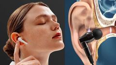 Earbuds:ನೀವು ಯಾವಾಗಲೂ ಇಯರ್‌ಬಡ್ಸ್‌ ಬಳಕೆ ಮಾಡುತ್ತೀರಾ? ಹಾಗಿದ್ರೆ ಈ ಸಮಸ್ಯೆ ಕಟ್ಟಿಟ್ಟಬುತ್ತಿ!