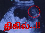 கருவில் குழந்தையை கண்காணிக்கும் துர்தேவதை, திகில் கிளப்பும் அல்ட்ராசவுண்ட் போட்டோ..!!