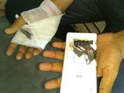 கையில் வெடித்துச் சிதறிய ஜியோ ஸ்மார்ட்போன்.!!