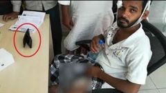 காலுடன் கபாலத்தை காவு வாங்கிய ஒப்போ ஸ்மார்ட்போன்.! ஒப்போ மக்களே உஷார்.!