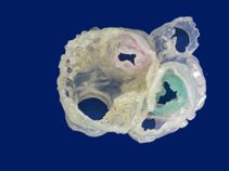 First 3D heart printed using multiple imaging techniques