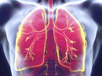 3D-imaging technique to precisely spot deadly lung disease