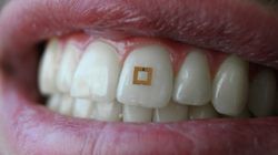 Adios fitness bands, tooth-mounted sensors to track your health and diet