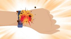 Smart Band Explodes On User's Wrist Leaving Third-Degree Burns