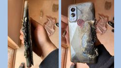 Another OnePlus Nord 2 Bursts Into Flames: User Suffers Heavy Burns