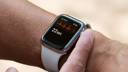 Apple Watch Series 10 Might Finally Get Galaxy Watch-Inspired Blood Pressure Monitoring Feature Apple Watch Series 10 Might Finally Get Galaxy Watch-Inspired Blood Pressure Monitoring Feature