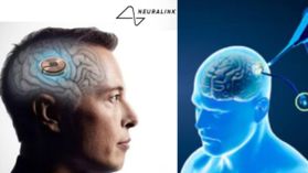 మనిషి మెదడుకి విజయవంతంగా చిప్ అమరిక! అనుకున్నట్లు గానే పనిచేస్తోంది!