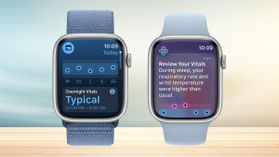 Apple Vitals App ఆరోగ్య సమస్యలు వస్తాయని ముందుగానే చెప్పేసే ఆపిల్ వాచ్ ఫీచర్.. ఎలా పనిచేస్తుంది..? Apple Vitals App ఆరోగ్య సమస్యలు వస్తాయని ముందుగానే చెప్పేసే ఆపిల్ వాచ్ ఫీచర్.. ఎలా పనిచేస్తుంది..?