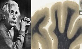 ಆಪಲ್‌ ಆಪ್‌ ಸ್ಟೋರ್‌ನಲ್ಲಿ ಐನ್ಸ್‌ಟೈನ್‌ನ ಮೆದುಳು ಖರೀದಿಸಿ