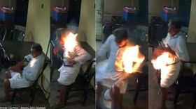 ഫോൺ പൊട്ടിത്തെറിച്ച് പോക്കറ്റിൽ നിന്നും ശരീരത്തിലേക്ക് തീ പടർന്നുകയറി; നടുക്കം മാറാതെ വയോധികൻ