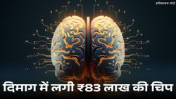 इंसानी दिमाग में लगी ₹83 लाख की चिप, Neuralink के बाद Paradromics का कारनामा!