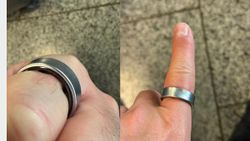 Youtuber के पहनते ही सूज गई और हाथ में फंस गई  Samsung Galaxy Ring, जानें डिटेल