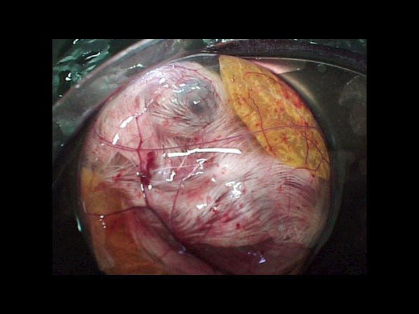 देखिए कैसे पेट्ट्री डिश में हुआ चूज़े का विकास 