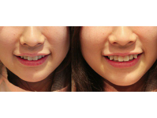 14 अजीबो-गरीब ब्यूटी गैजेट्स..!!