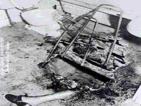 विक्टिम के बॉडी पार्ट्स