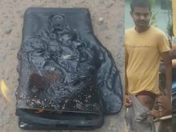 रेड्मी नोट 4 के फटने का सिलसिला जारी, जल गया युवक का पैर रेड्मी नोट 4 के फटने का सिलसिला जारी, जल गया युवक का पैर