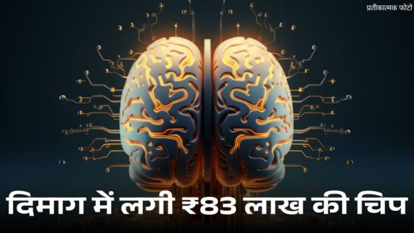 Paradromics ने दिमाग में लगाया चिप, कीमत ₹83 लाख