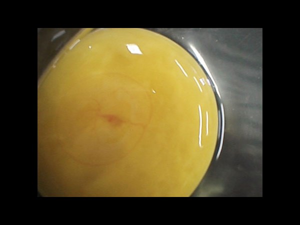 Google Interactive Doodle Marks Richard Petri Birthday: 5 Facts about the Petri Dish Invention