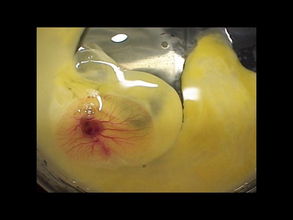 Google Interactive Doodle Marks Richard Petri Birthday: 5 Facts about the Petri Dish Invention