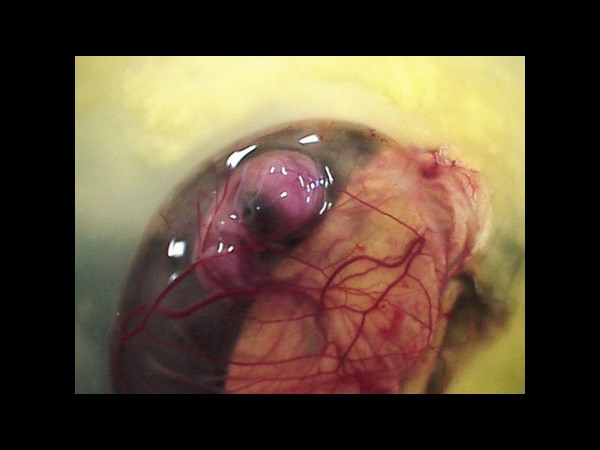 Google Interactive Doodle Marks Richard Petri Birthday: 5 Facts about the Petri Dish Invention