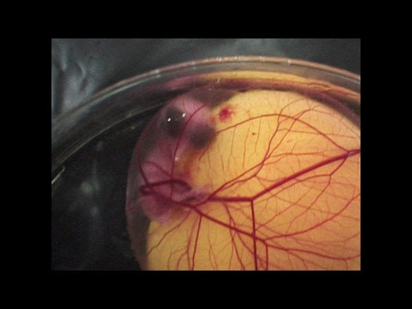 Google Interactive Doodle Marks Richard Petri Birthday: 5 Facts about the Petri Dish Invention