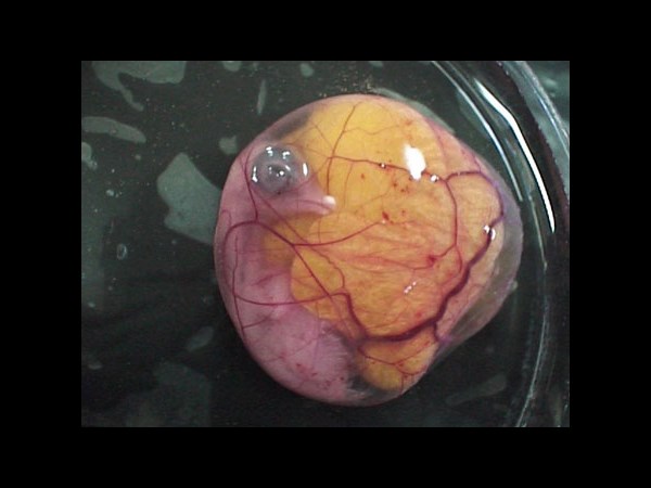 Google Interactive Doodle Marks Richard Petri Birthday: 5 Facts about the Petri Dish Invention