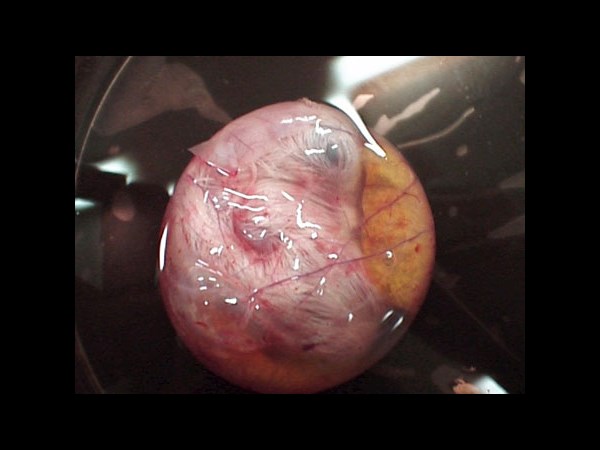 Google Interactive Doodle Marks Richard Petri Birthday: 5 Facts about the Petri Dish Invention